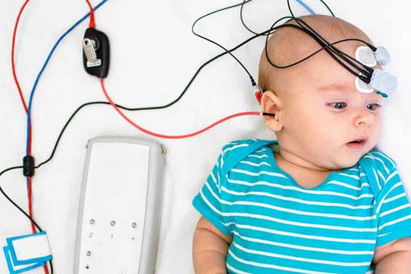 Auditory-Brainstem-Response