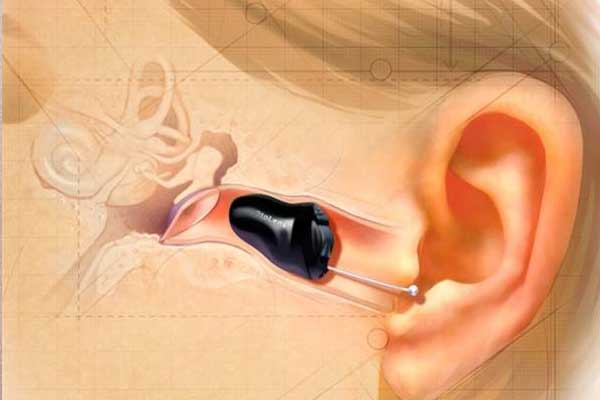 Invisible in the canal hearing aid
